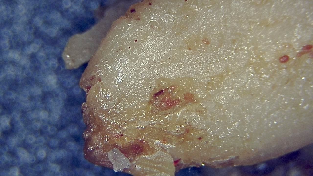 Food Industry microscopy sample image 15