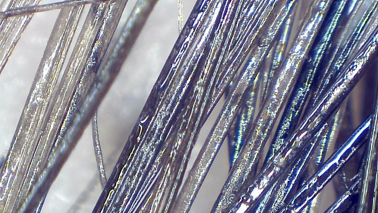 Trichoscopy for Hair and Scalp microscopy sample image 6