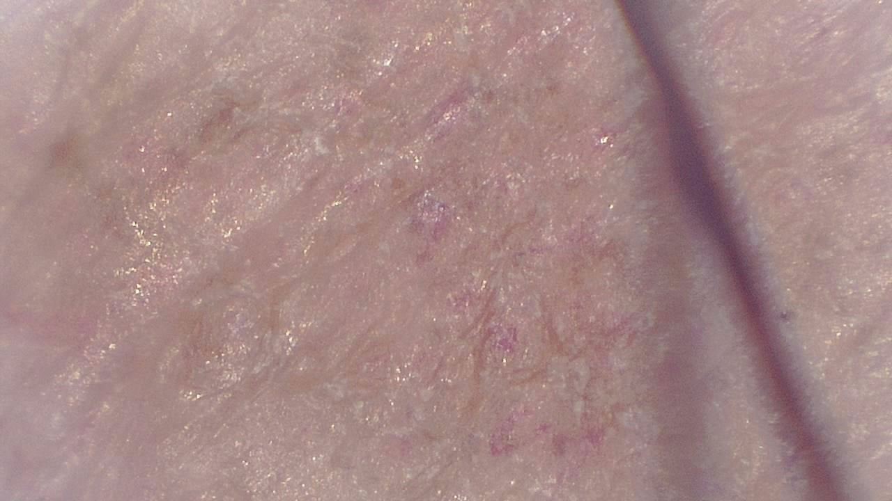 Advanced Aesthetics and Cosmetology microscopy sample image 10