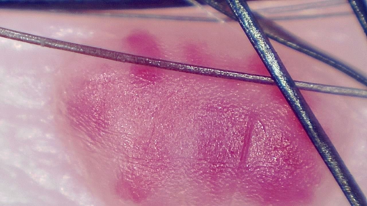 Advanced Aesthetics and Cosmetology microscopy sample image 13