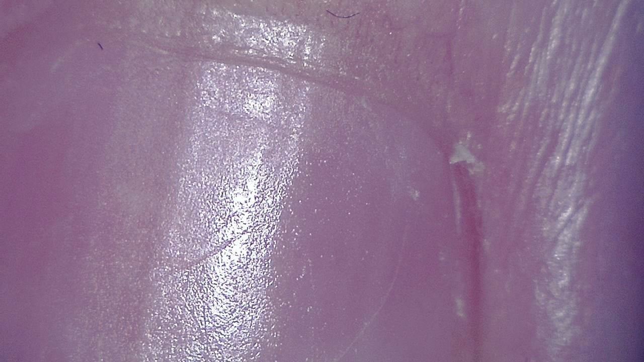 Podiatry microscopy sample image 5