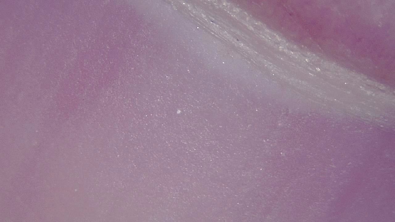 Podiatry microscopy sample image 9