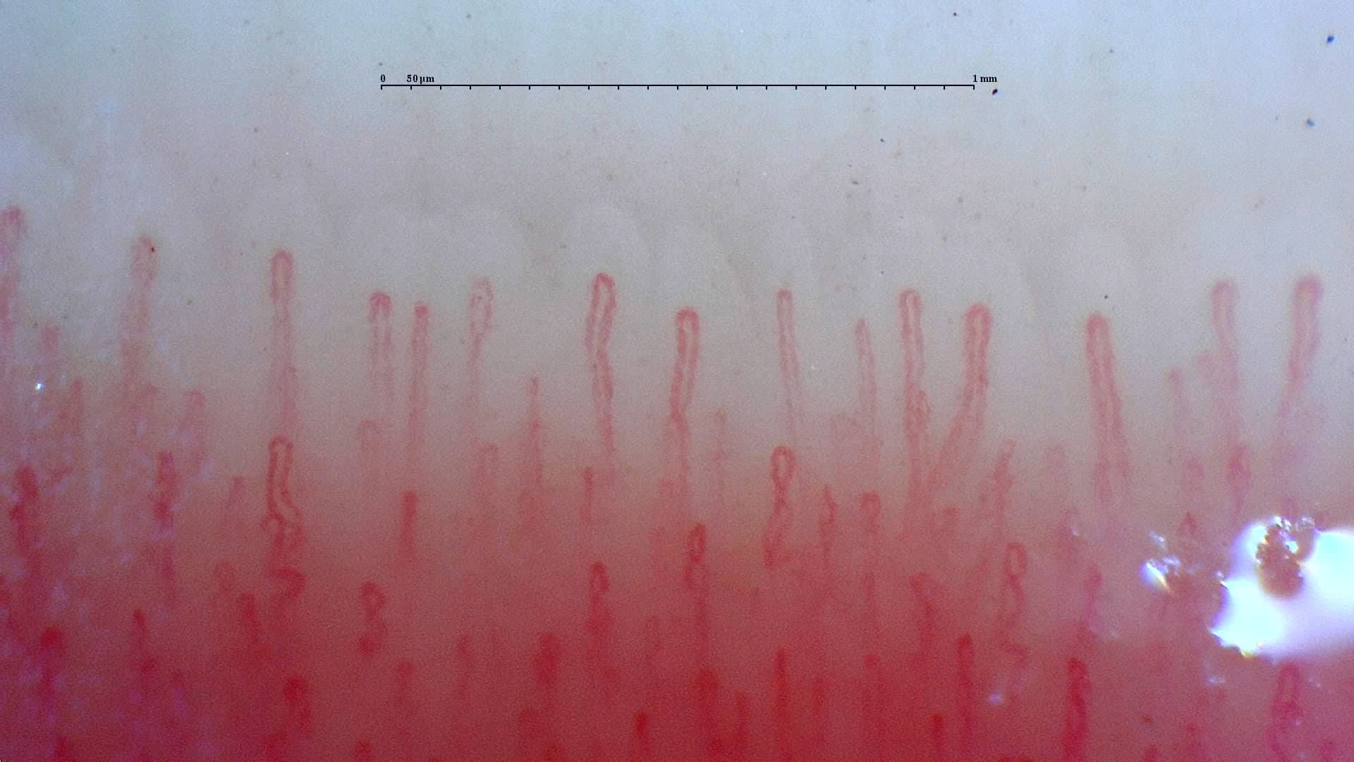 Nailfold Capillaroscopy microscopy sample image 2